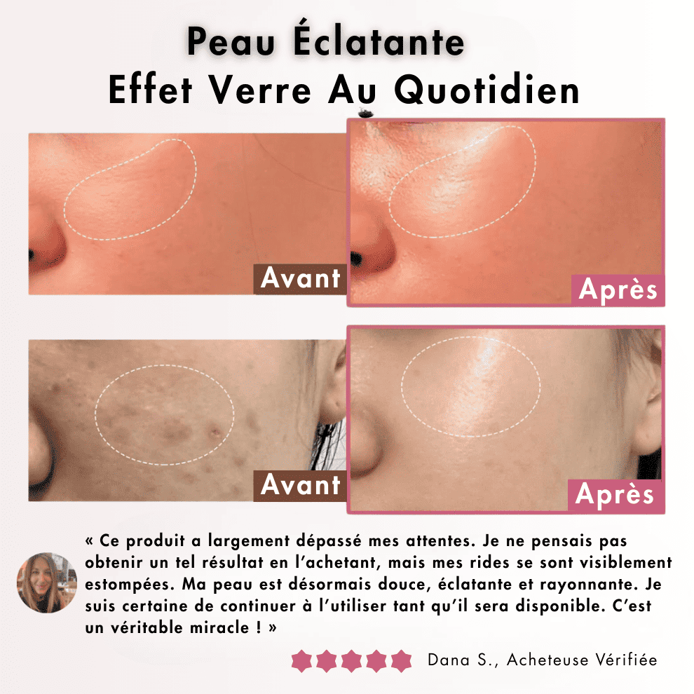 Aufemininshop™ – Crème Collagène Jelly Anti-Âge 100ml - SOLANIM